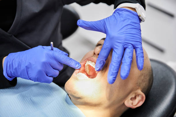 Best Broken or Chipped Tooth Repair in Martin, TN