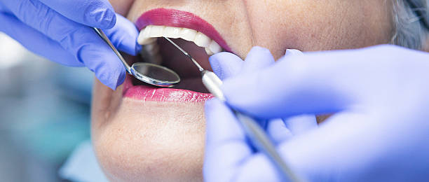 Best Emergency Dental Care for Sports Injuries in Martin, TN